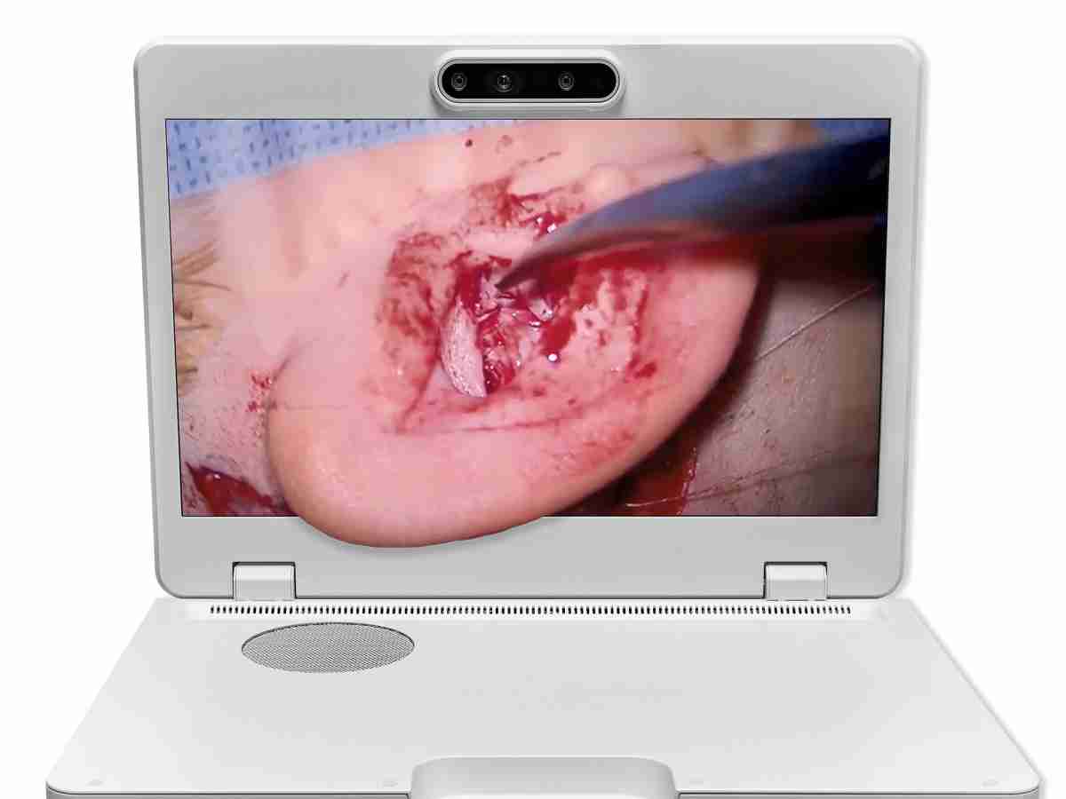 达擎之＂Heads-up 3D显微手术显示系统＂，，，，整合4K裸眼3D显示及眼球追踪系统，，，具备快速追踪人眼移动位置功能，，，，减轻医师长时间维持固定姿势的负担，，，让医师能有更宽广清晰的3D立体视野及更舒适的姿势来执行手术。。。